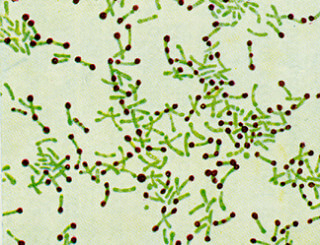Corynebacterium diphtheriae. Photo credit: isis325 via Visual hunt / CC BY